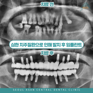 양지동치과