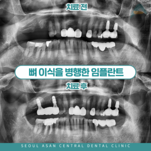 양지동치과