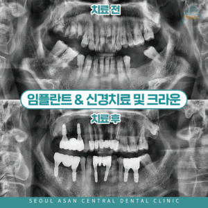 메인