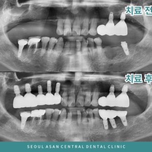 제목을-입력해주세요_-012