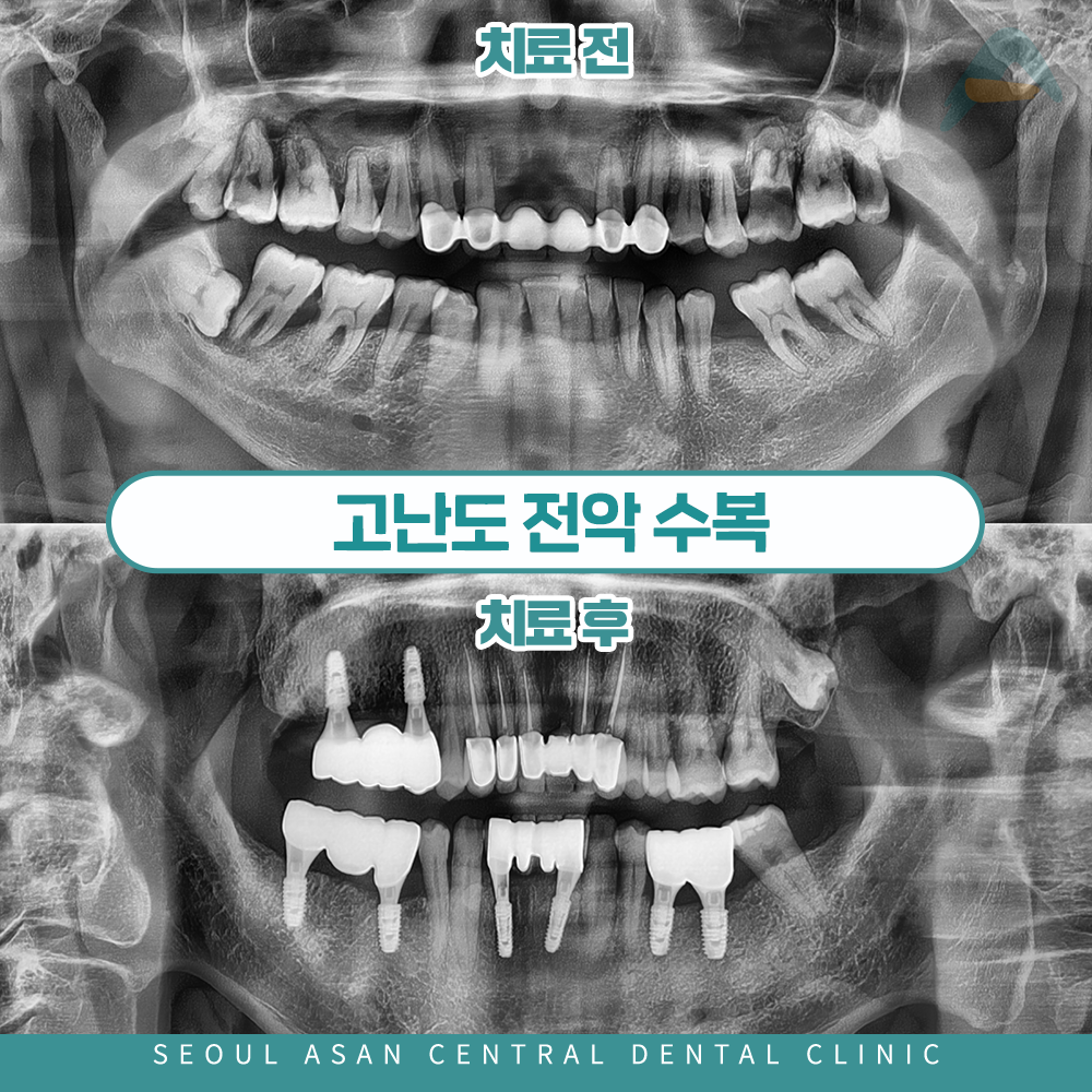 서울아산센트럴치과