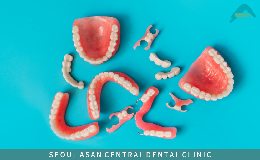 성남잇몸뼈부족치료방법