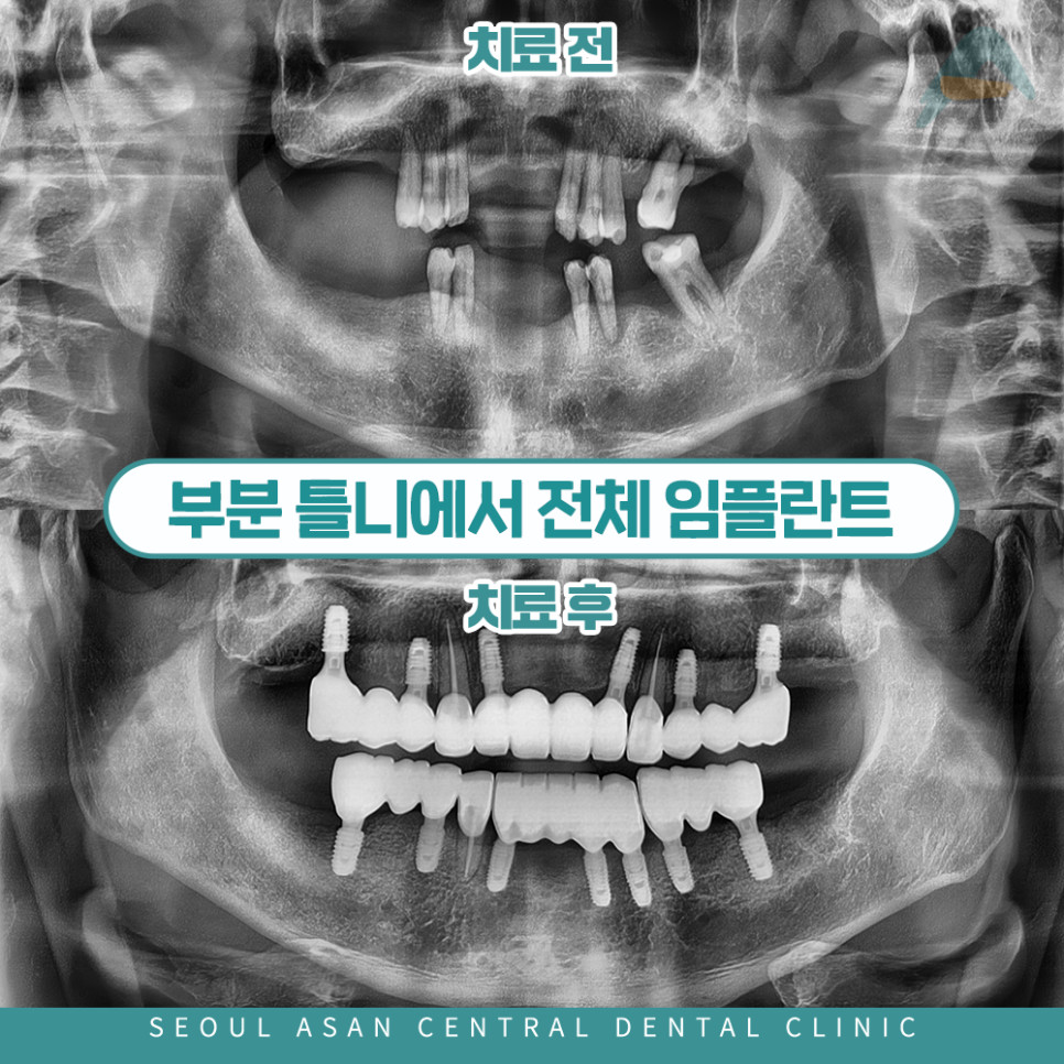 성남치과
