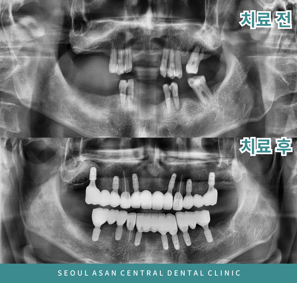 은행동치아복원치과